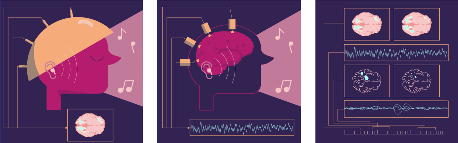 Artistic illustration representing neural dynamics and brain activity patterns